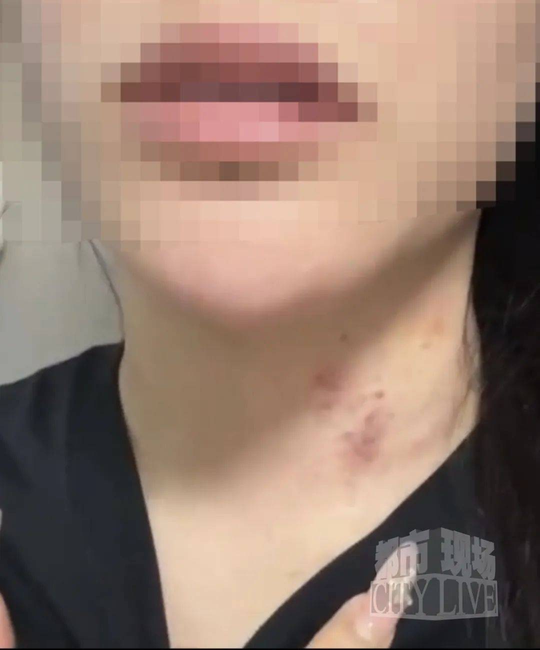 皇冠信用网代理流程_湖南衡阳29岁女子疑被男友施暴后从25楼跳下身亡 男友徐某此前还刺激说：“你放心皇冠信用网代理流程，她不会去死的”