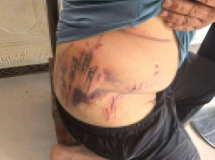 白俄罗斯 vs丹麦
_湖北鹤峰县疑再现老虎踪迹白俄罗斯 vs丹麦
，村民家猪遭袭，玉米地发现脚印，此前男子自称干农活时被抓伤，当地回应