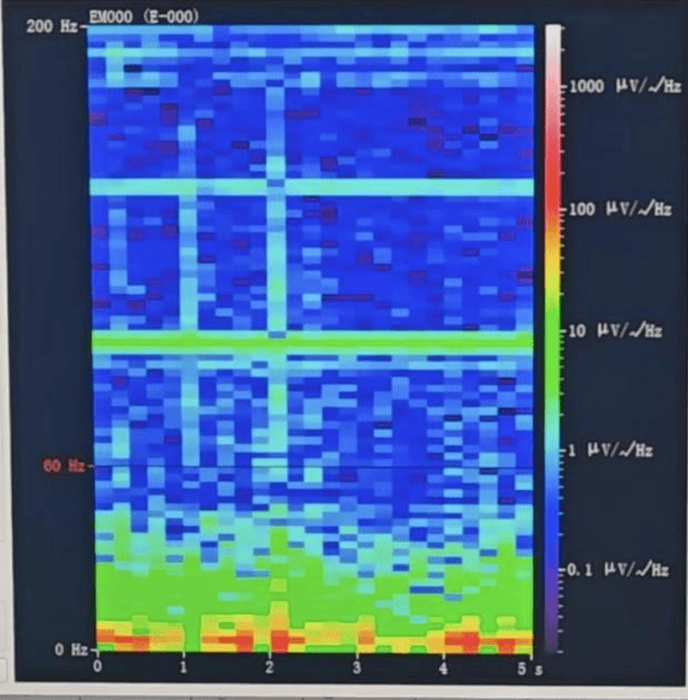 皇冠信用盘登1,登2,登3出租
_山西首例皇冠信用盘登1,登2,登3出租
!山西省人民医院成功实施脑机接口辅助功能区脑肿瘤切除手术
