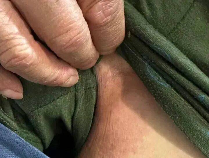 皇冠信用需要押金吗
_68岁大伯被蚂蚁围攻送进抢救室！短短十几秒爬满全身皇冠信用需要押金吗
，罪魁祸首竟是院子里的“宝贝”